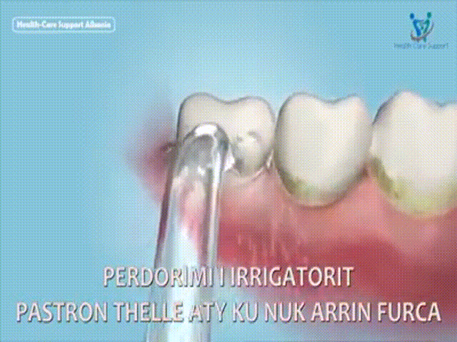 Irrigatori Oral